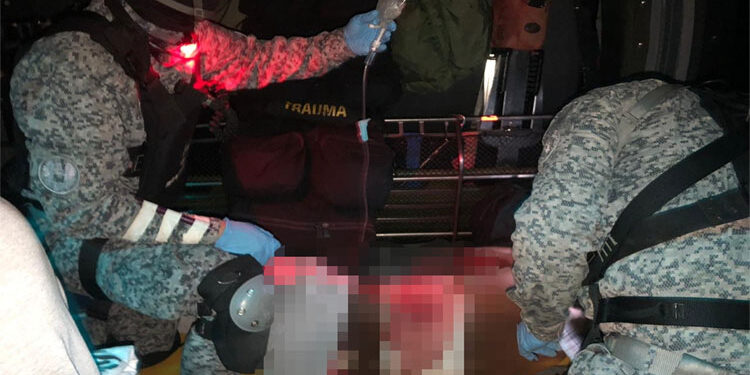 Guerrillero herido del ELN se entregó en Alto Baudó