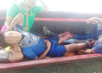 Menor indígena perdió un pierna en campo minado