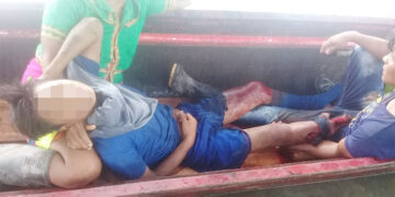 Menor indígena perdió un pierna en campo minado