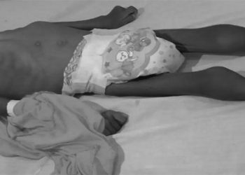 Chocó: aumentan los niños muertos por desnutrición