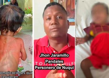 ¡Alerta por desnutrición en el Chocó! Personero de Nuquí exige traslado urgente de dos menores en estado crítico