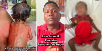 ¡Alerta por desnutrición en el Chocó! Personero de Nuquí exige traslado urgente de dos menores en estado crítico
