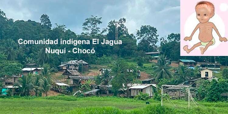 Chocó: más de nueve casos de desnutrición infantil en Nuquí