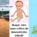 Nuquí, Chocó: otro caso crítico de desnutrición infantil