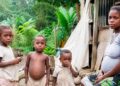 Denuncian irregularidades en convenio para atender desnutrición infantil en Chocó