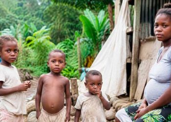 Denuncian irregularidades en convenio para atender desnutrición infantil en Chocó